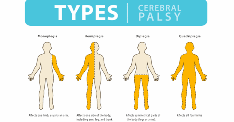 Cerebral Palsy Stem Cell Therapy India: A New Horizon for Hope and Healing